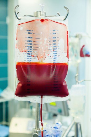 blodtransfusion