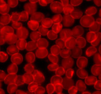 röda blodkroppar