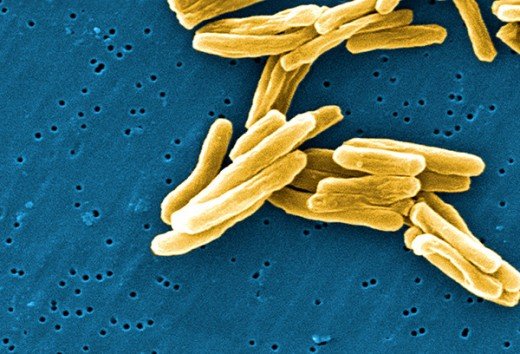 Mycobacterium-tuberculosis