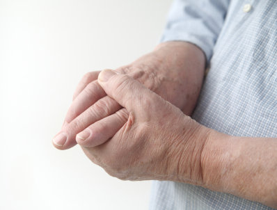 reumatism symtom fingrar