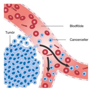 Cancerceller metastaserar